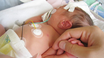 Mengenal 5 Jenis Penyakit Bayi Yang Harus Diwaspadai Orang Tua